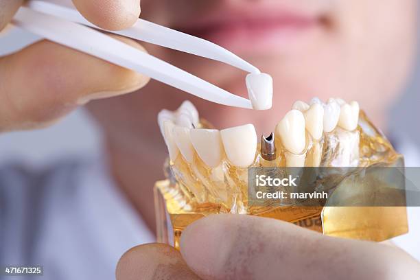 Arzt Mit Dental Audiosystem Stockfoto und mehr Bilder von Zahnimplantat - Zahnimplantat, Zahnpflege, Zahnarztausrüstung