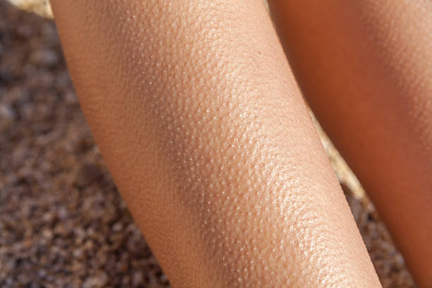 istock Horripilation from the cold on legs 471688380