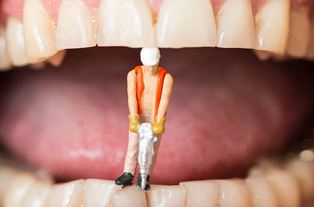 istock dental filling caries abstract with mini construction worker on teeth 471695096