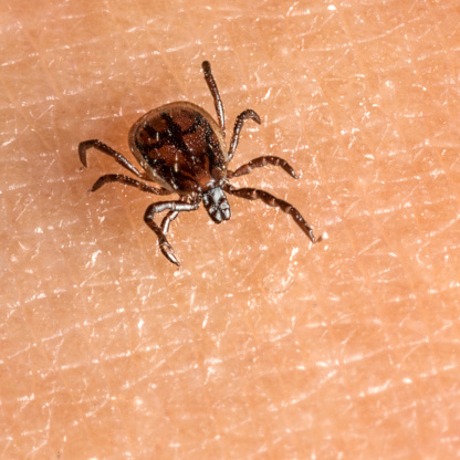 Tick crawling over human skin. Nikon D800e. Converted from RAW