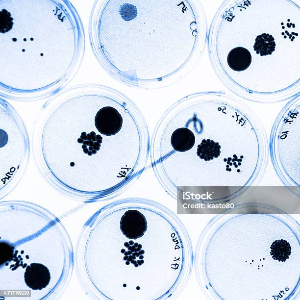 Crescita Di Batteri In Piastre Petri - Fotografie stock e altre immagini di Agar - Agar, Ambiente, Analizzare