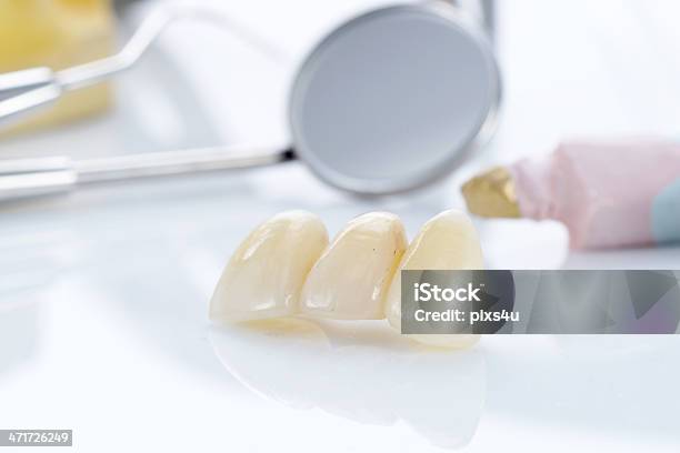 Macro De Dentes Protético Com Ferramentas De Dentista - Fotografias de stock e mais imagens de Acessório