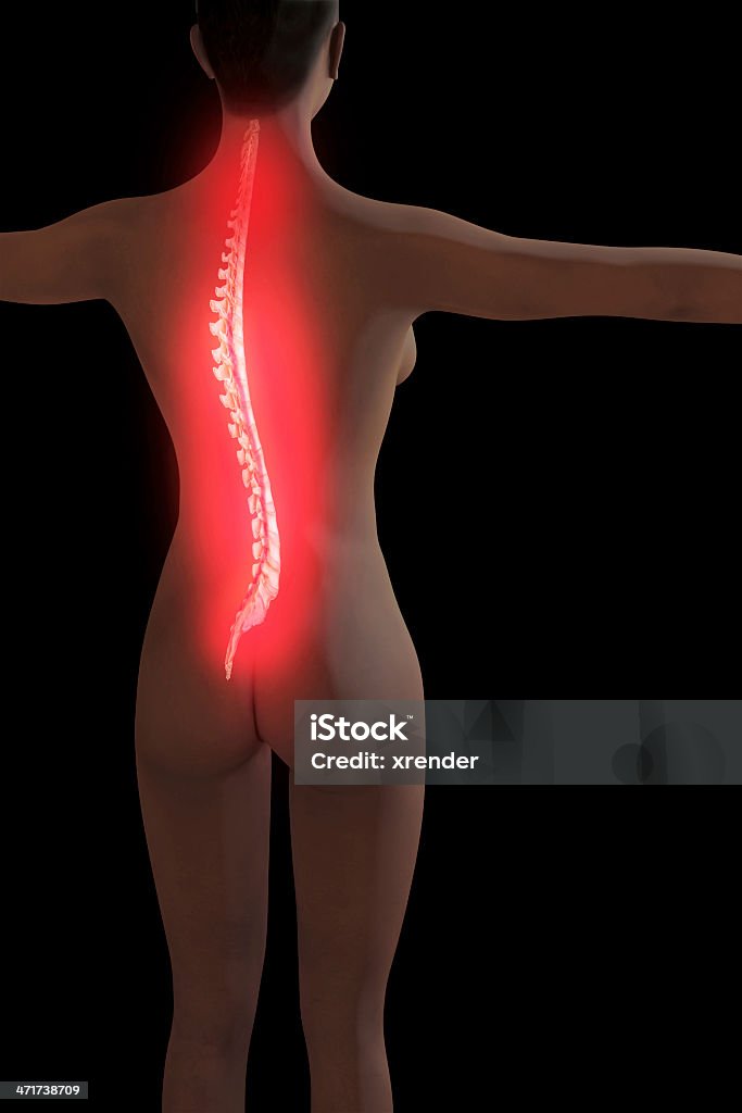 背中の痛み-3 D レンダリングされた図 - 3Dのロイヤリティフリーストックフォト