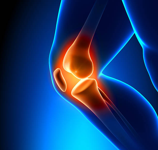 close-up de dolorosa joelho - human joint human knee pain x ray imagens e fotografias de stock