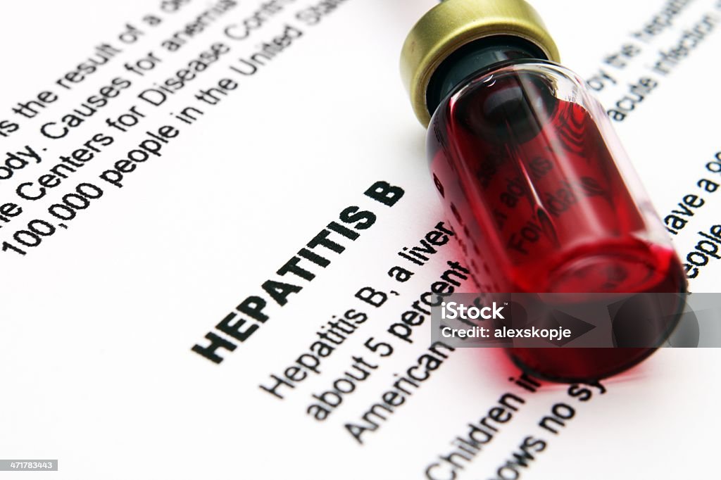 Hepatitis Acute Angle Stock Photo