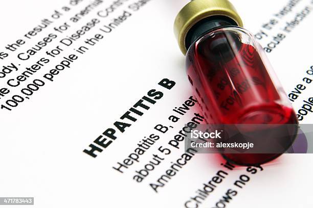 Hepatitis Stock Photo - Download Image Now - Acute Angle, Anatomical Substance, Doctor