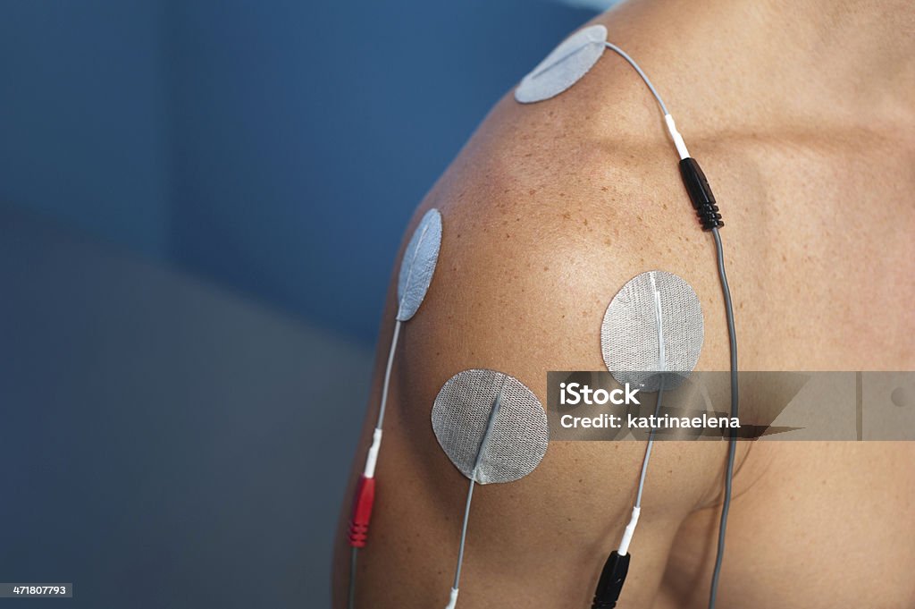 Shoulder Electrical Stimulation / TENS Physical therapy or chiropractic treatment of a male patient's injured shoulder using transcutaneous interferential electrical stimulation (TENS) for pain management. Electrode Stock Photo