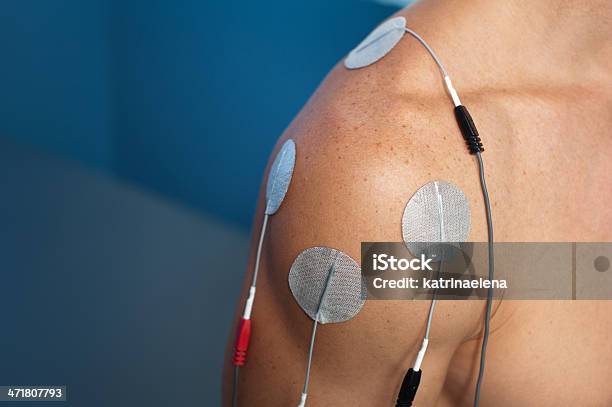 Shoulder Electrical Stimulation Tens Stock Photo - Download Image Now - Electrode, Physical Therapy, Rotator Cuff
