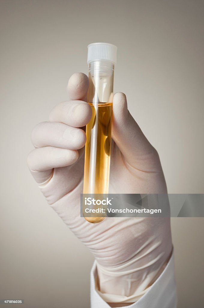 Mão de médico com Amostra de Urina - Foto de stock de Exame de Drogas royalty-free