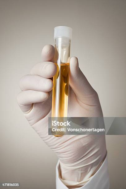 Foto de Mão De Médico Com Amostra De Urina e mais fotos de stock de Exame de Drogas - Exame de Drogas, Laboratório, Amarelo