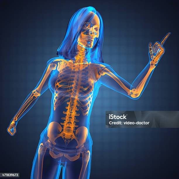 Mulher Engraçada Radiografia - Fotografias de stock e mais imagens de Adulto - Adulto, Anatomia, Articulação - Parte do corpo