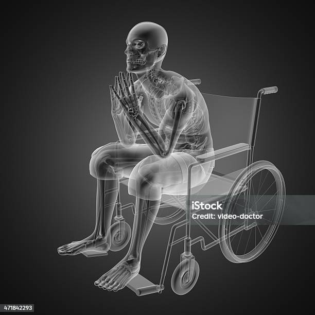 Mann Im Rollstuhl Stockfoto und mehr Bilder von Anatomie - Anatomie, Andersfähigkeiten, Arthritis