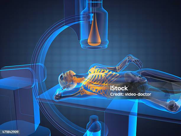 Xray Untersuchung Stockfoto und mehr Bilder von Anatomie - Anatomie, Arthritis, Biologie