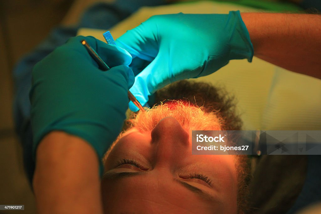 Young man at dentist's having a tooth filled young man getting  a tooth filled at the dentist's office Adult Stock Photo