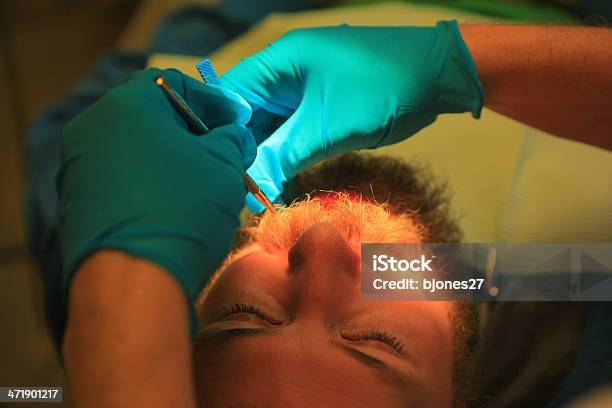 Young Man At Dentists Having A Tooth Filled Stock Photo - Download Image Now - Adult, Apron, Built Structure
