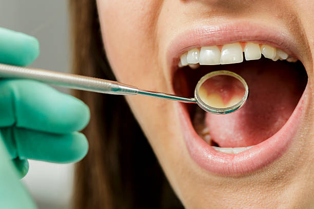 istock Young woman at the dentist 471915701