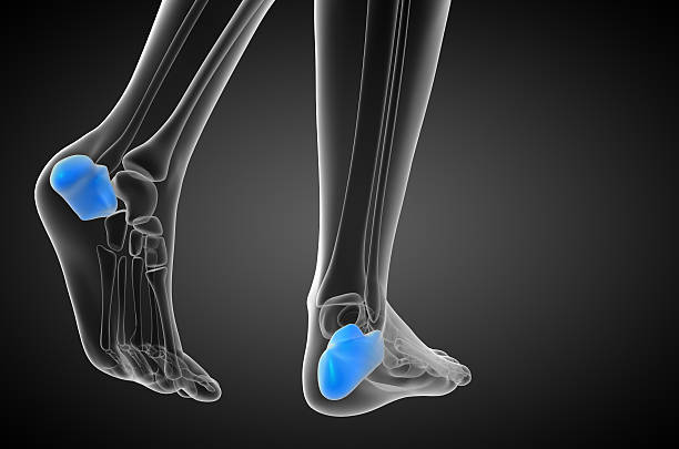 istock 3d render medical illustration of the calcaneus bone 471915908