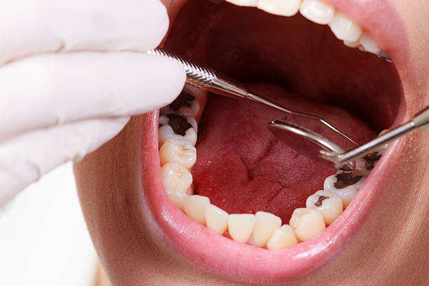 istock dental treatment at the dentist 472004253