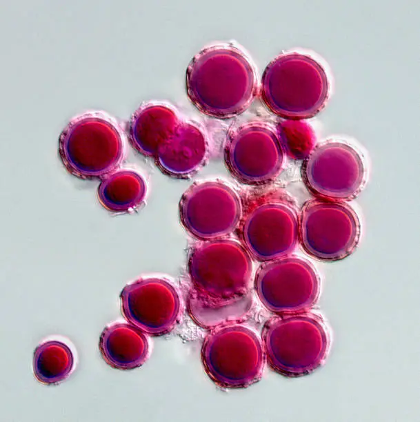 Spores of the fungus Chaetomium stained with acid fuchsin to colour them deep red. This fungus is a very common cellulose decomposer resulting in rotting of many natural products. The image was recorded with a microscope fitted with differential interference contrast, which provides high degree of contrast at maximum aperture resulting in maximum resolution.