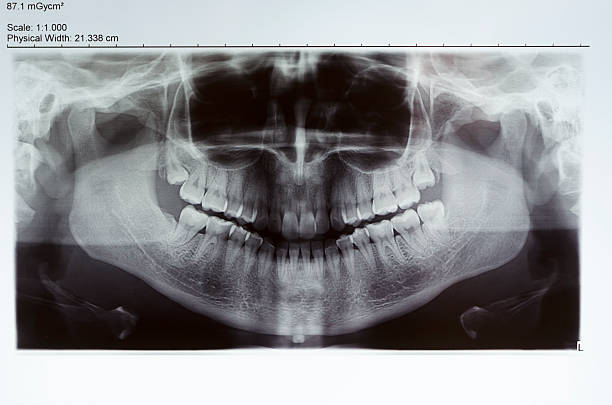 x-ray - radiogram photographic image photos et images de collection