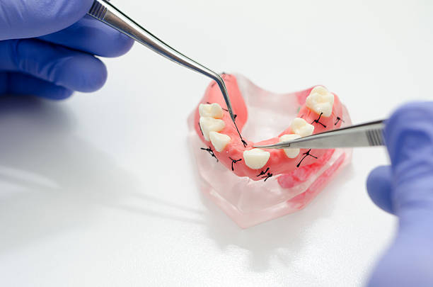 インプラント - dental hygiene laboratory dental equipment technician ストックフォトと画像
