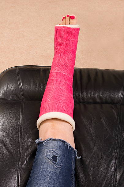 Lady con gamba Fracture - foto stock