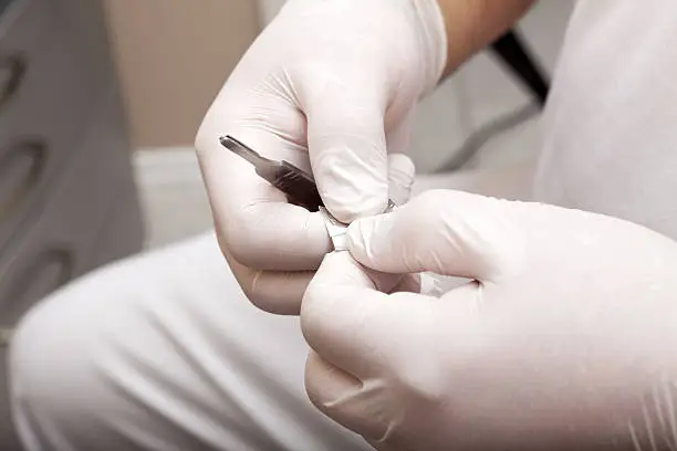 Chiropodists unpacks a scalpel blade