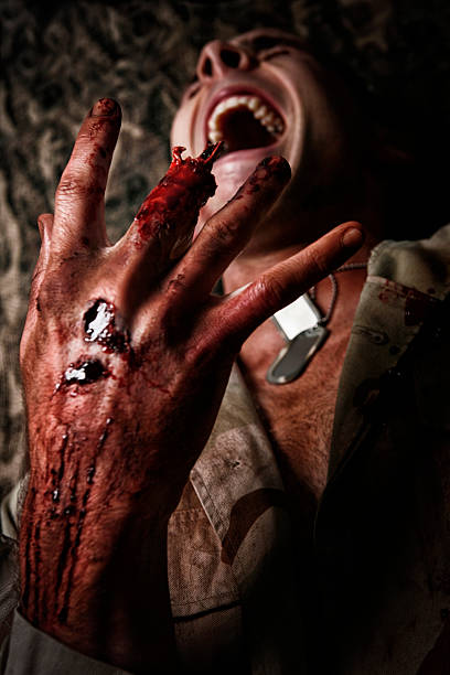 istock Military Man With Severed Finger 472222799