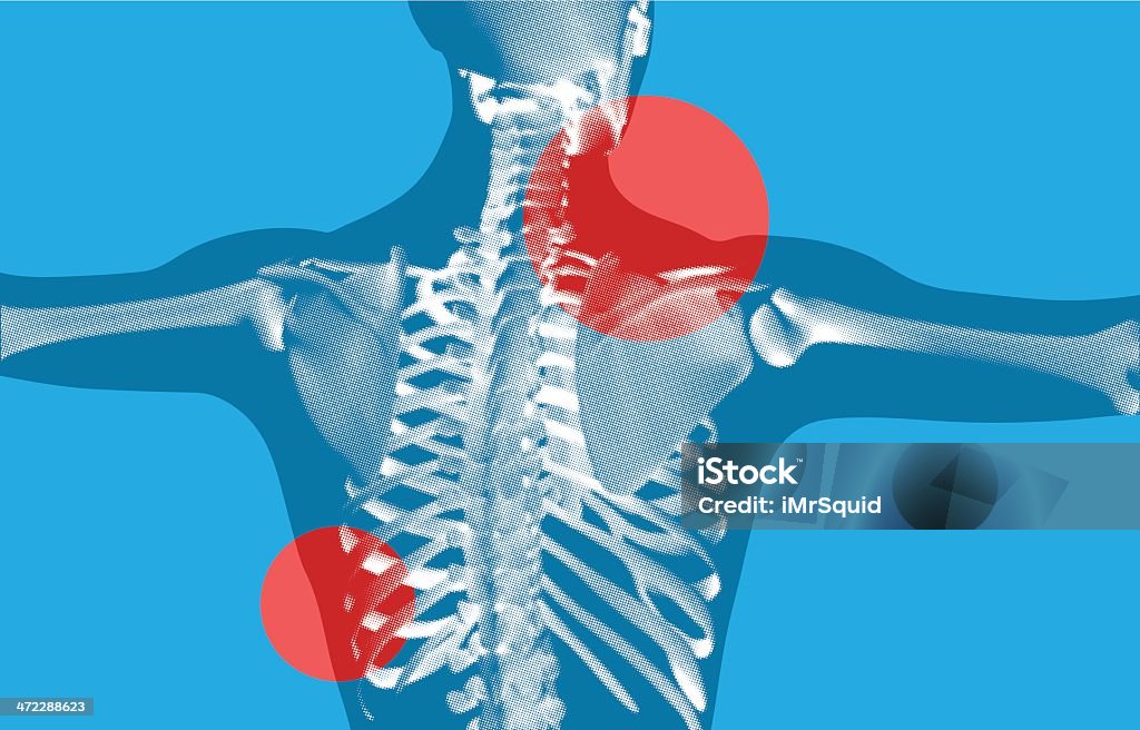 バックの骨格 X 線スキャン - 人体のロイヤリティフリーベクトルアート