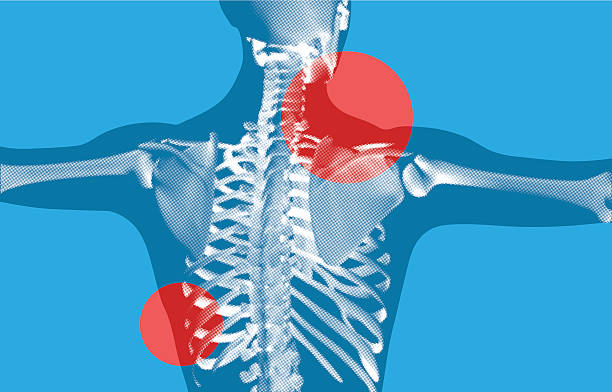 сзади сканирования рентгенография скелета, - human spine human bone human vertebra rib cage stock illustrations