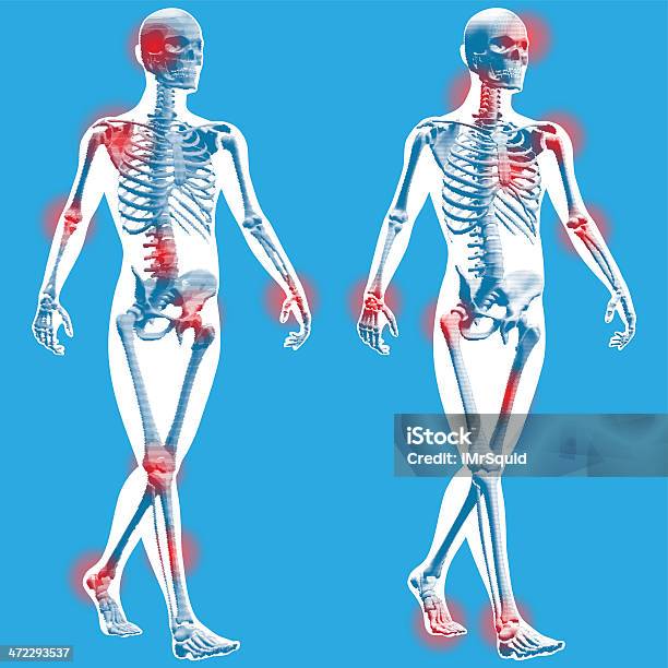 Figura Andarsemi Vista De Frente - Arte vetorial de stock e mais imagens de Anatomia - Anatomia, Andar, Antebraço