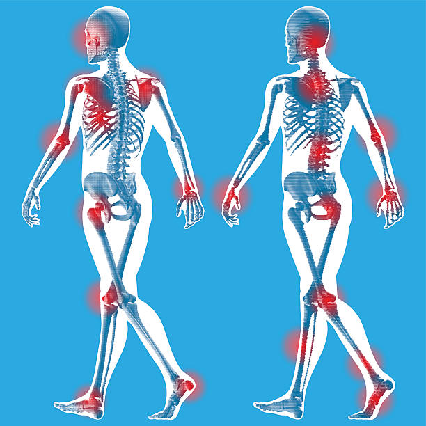 рисунок ходьба-полупрозрачный вид сзади - human skeleton body the human body pain stock illustrations
