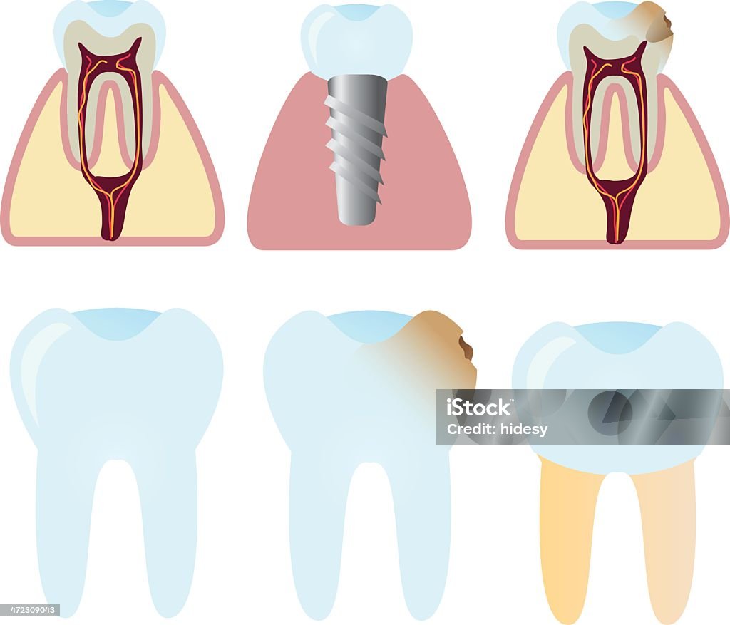 Dents et Dentistry - clipart vectoriel de Anatomie libre de droits