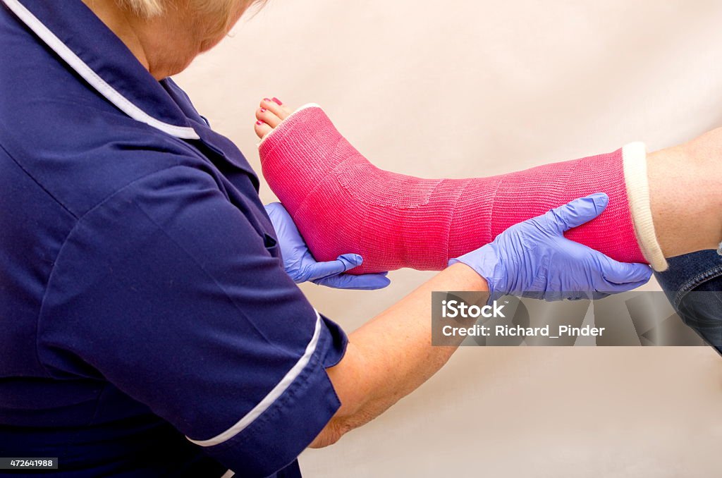 Nurse checking woman's broken leg in pink cast A nurse treating a ladies fractured leg in a pink cast Nurse Stock Photo