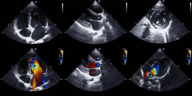 Six frames of echocardiography results Echocardiography set of patterns cusp stock pictures, royalty-free photos & images