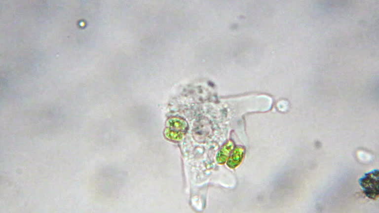 amoeba micrograph