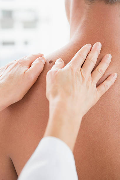 istock Doctor examining a spot at his patient 472904584