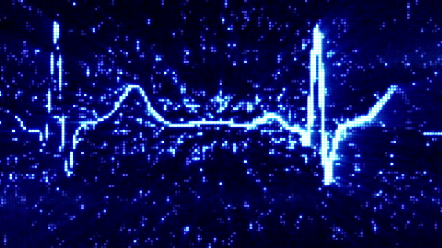digital pixel EKG electrocardiogram pulse blue loopable background