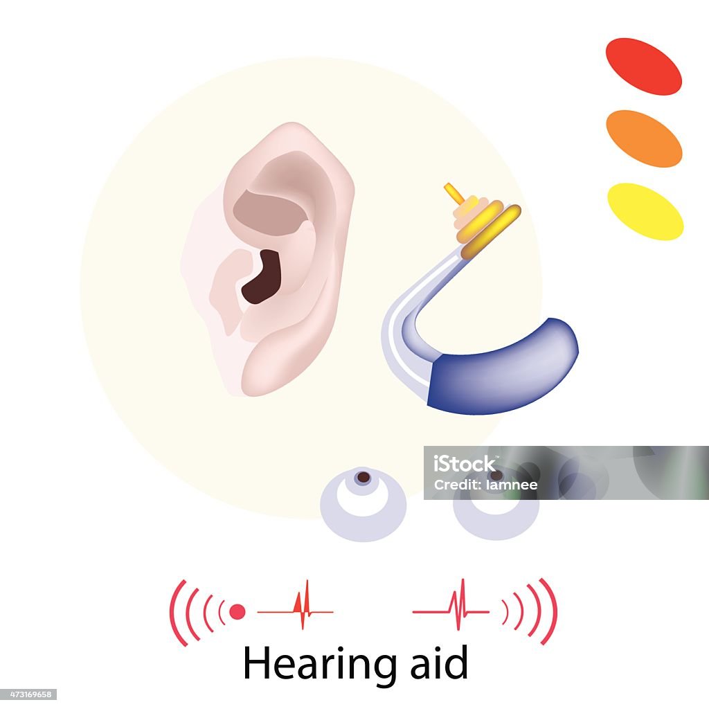 Patient with Hearing Aid on White Background Illustration of Hearing Aid or Deaf Aid, A Device Which Amplifies Sound for The Wearer to Hear Better. 2015 stock vector