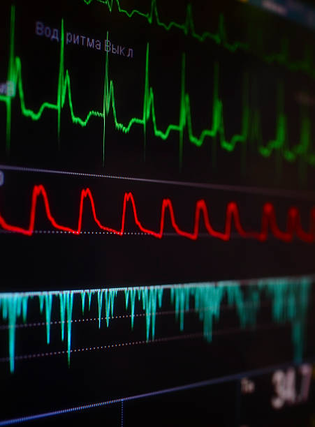 istock Cardiomonitor with a bright fragment of waves 473288064