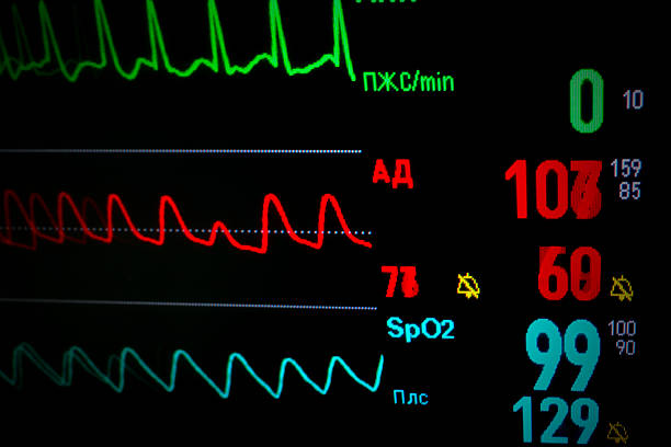 istock Screen medical monitor in dynamic. 473298364