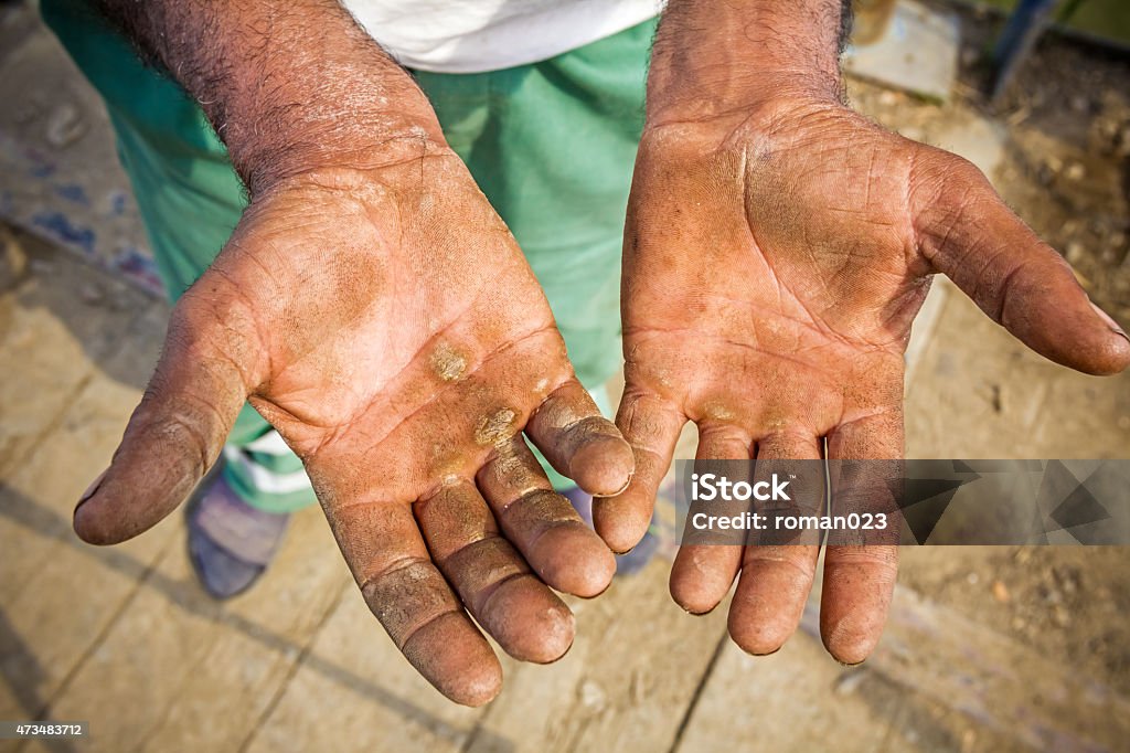 Injured open palms Worker is showing his chapped hands, dirty and injured palms. Blue-collar Worker Stock Photo