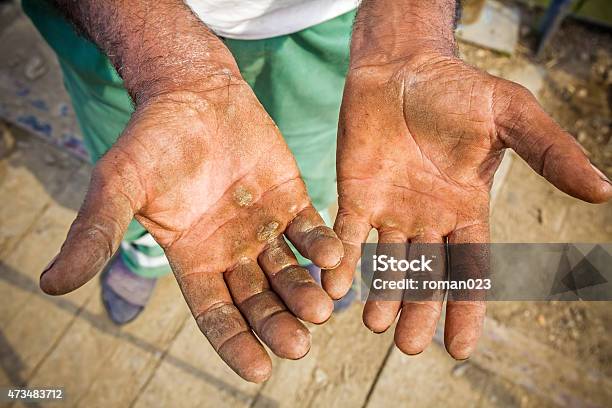 Injured Open Palms Stock Photo - Download Image Now - Blue-collar Worker, Effort, Palm of Hand