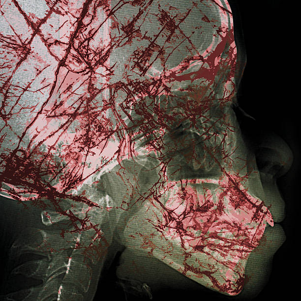 istock pathogen abstract with x-ray film background on double exposure 473676326