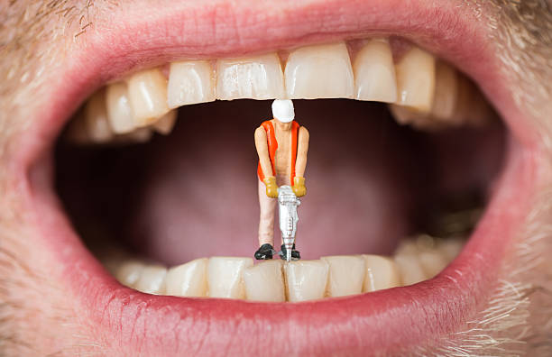 dental filling caries abstract with mini construction worker on teeth