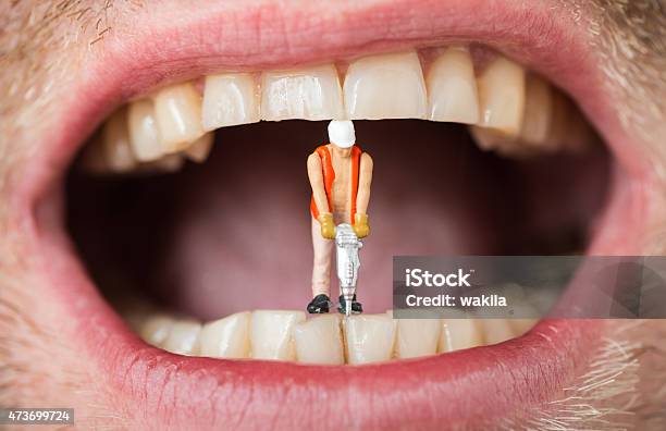 Dental Filling Caries Abstract With Mini Construction Worker On Teeth Stock Photo - Download Image Now