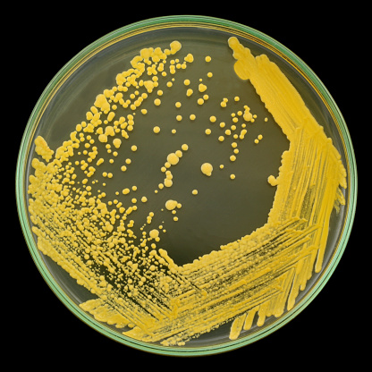 Yellow bacterial colonies on a petri plate ( dish ) isolated on a black background. Pure oil-degrading bacterial culture used. Nutrient agar media used.  