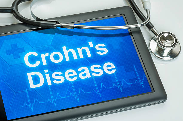 istock Tablet with the diagnosis Crohn's disease on the display 473827672