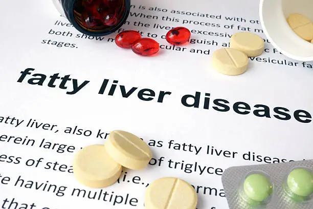 Photo of Paper with fatty liver disease and pills.