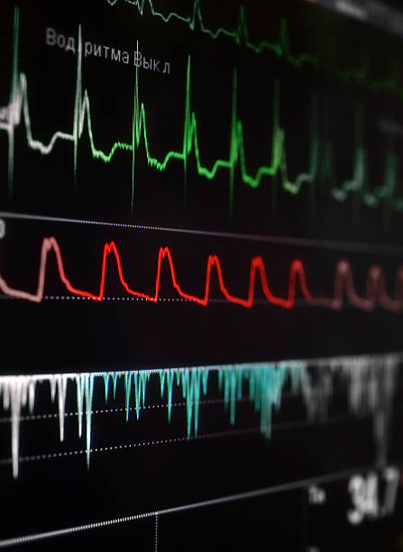 istock Cardiomonitor with a bright fragment of waves. 474138512